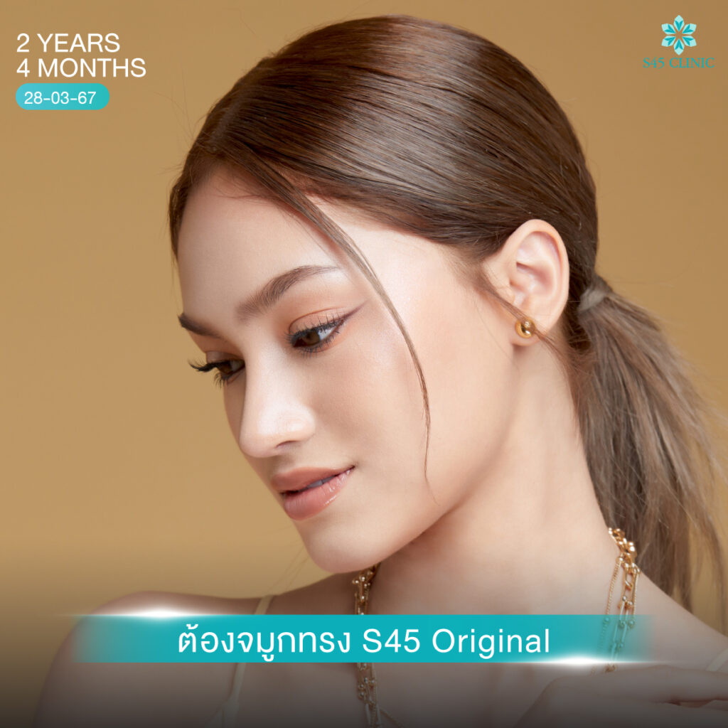 เสริมจมูก หมอตี้ 